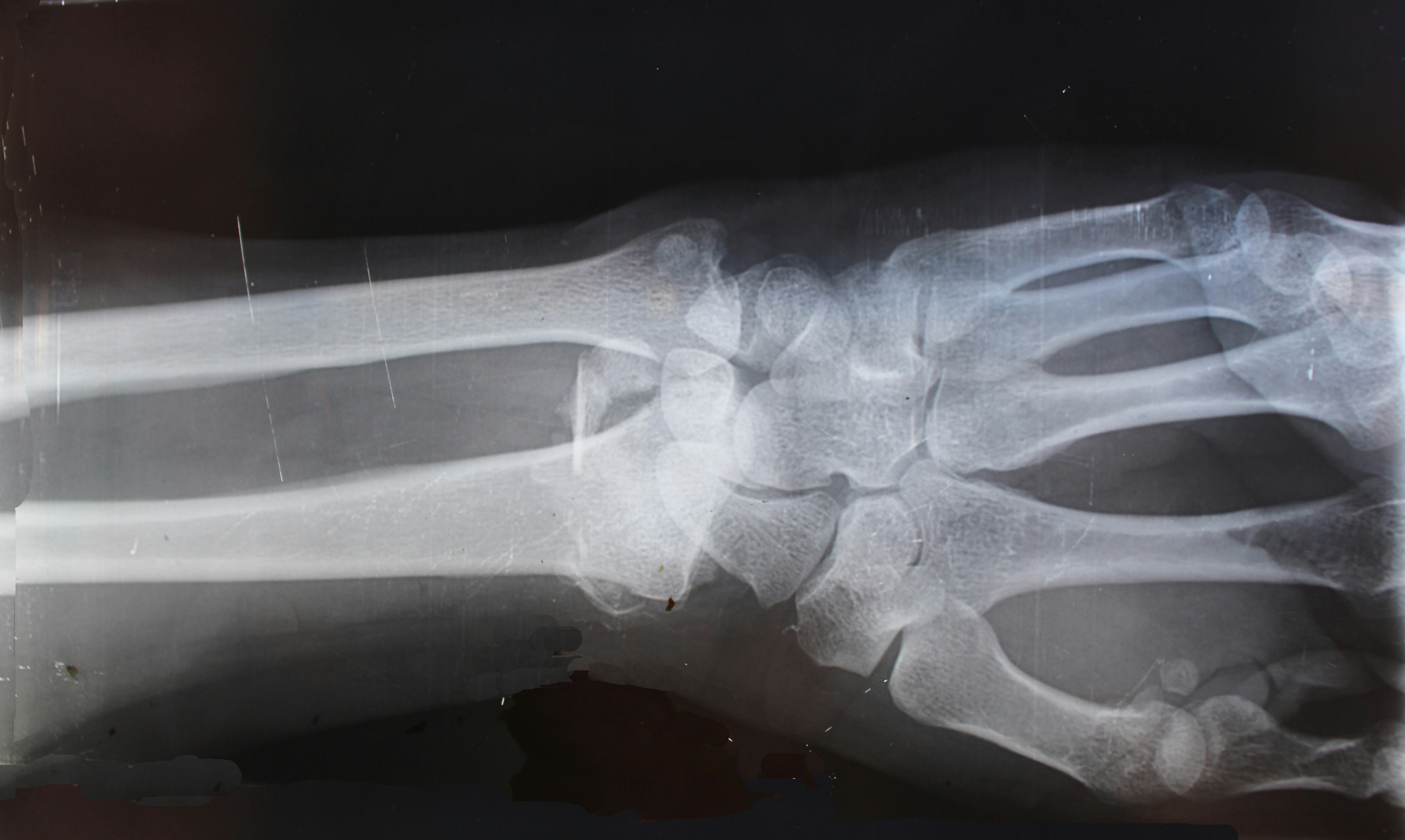 My Bones Were Breaking Without Making a Sound. Now I’m Speaking Up.